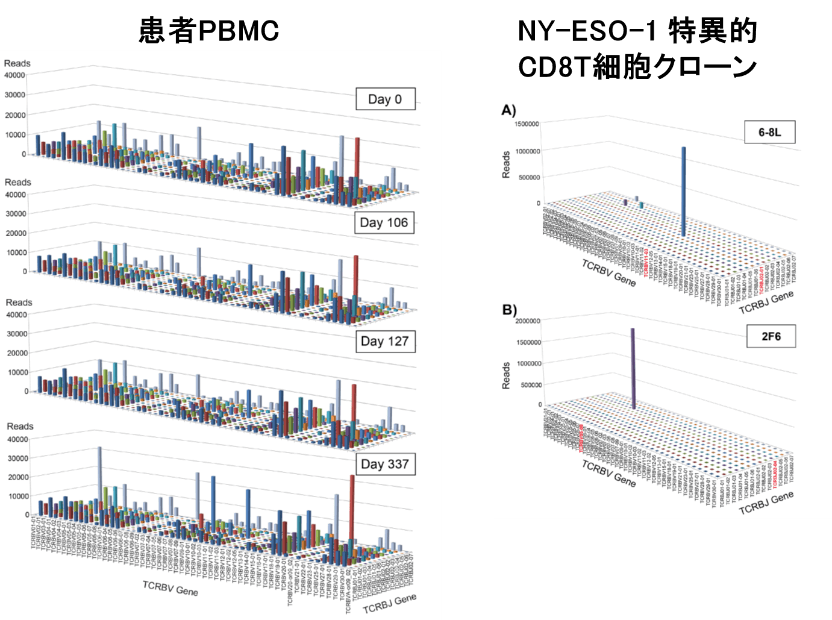 患者PBMC／NY-ESO-1 特異的CD8T細胞クローン