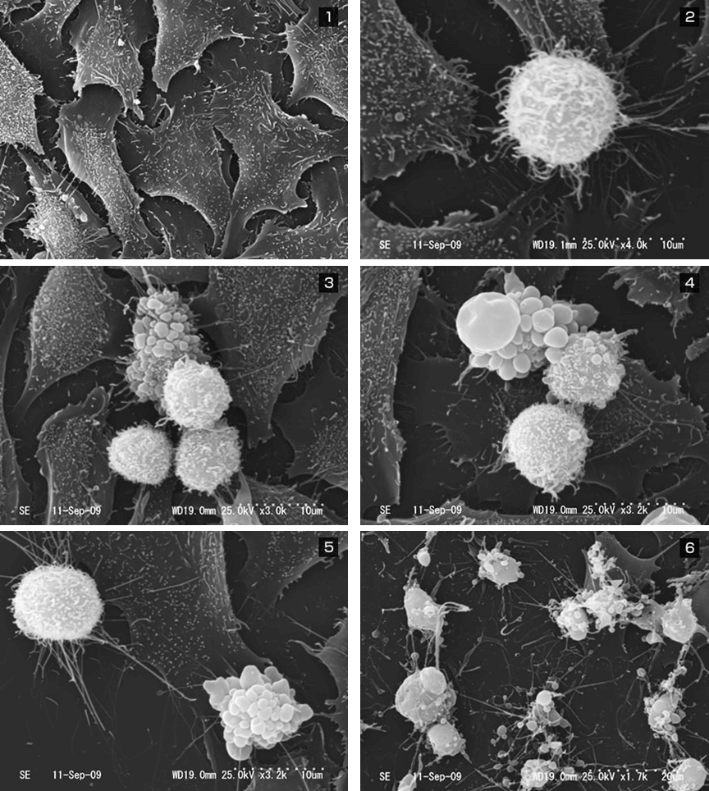 中心は、腫瘍特異的CD8+T細胞、CTL、ほかに免疫担当細胞が複数存在